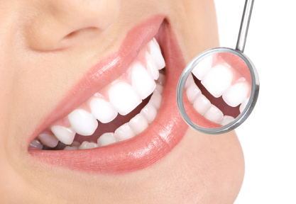 Tooth Whitening Comparison