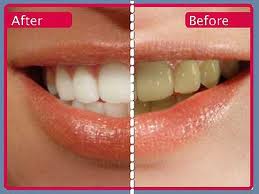 Whitening Reviews