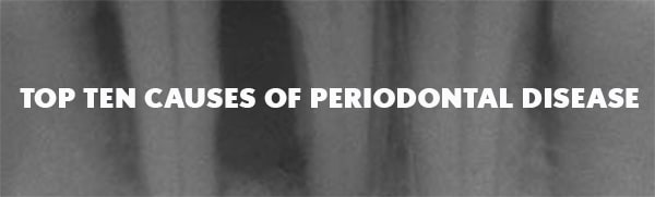 Top Ten Causes of Periodontal Disease