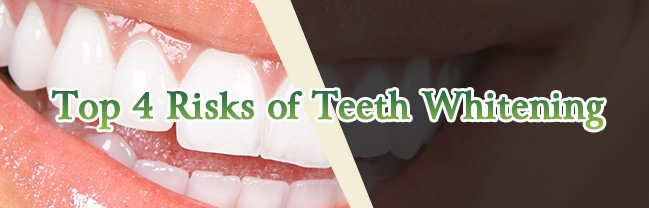 Top 4 Risks of Teeth Whitening