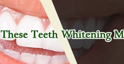 Avoid These Teeth Whitening Mistakes